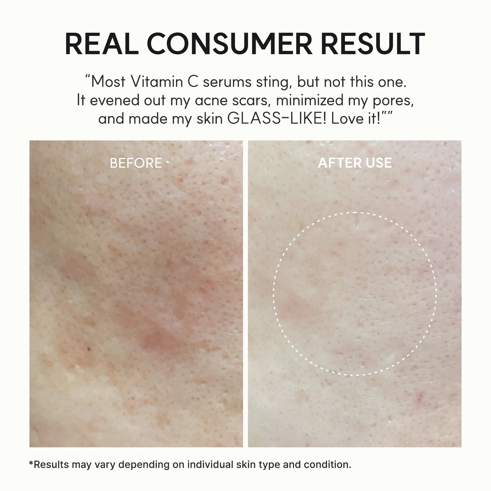 Vitamin C Booster Shot with Niacinamide for Glowing Skin & Hydration