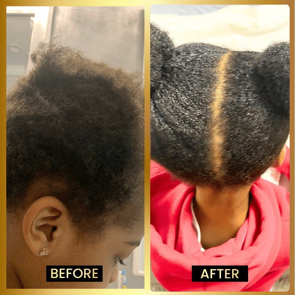 Stimulating Scalp & Hair Balm for Dry Scalp, Moisture & Healthy Hair