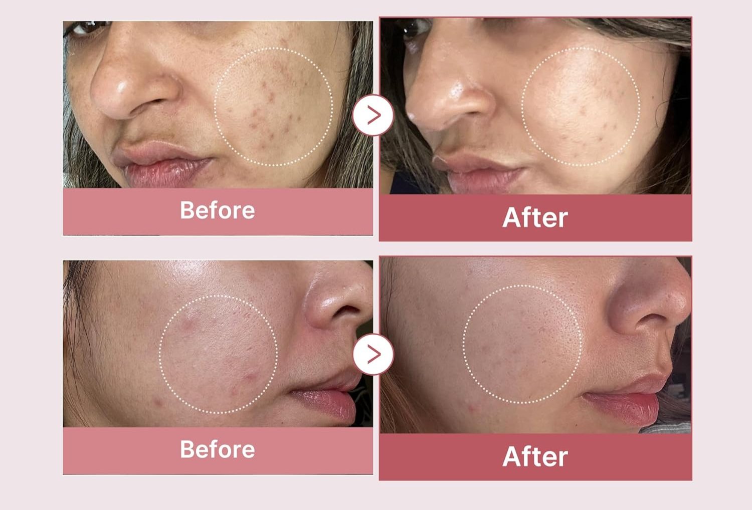 PDRN Pink Peptide Serum for Glowing Skin, Elasticity & Uneven Skin Tone