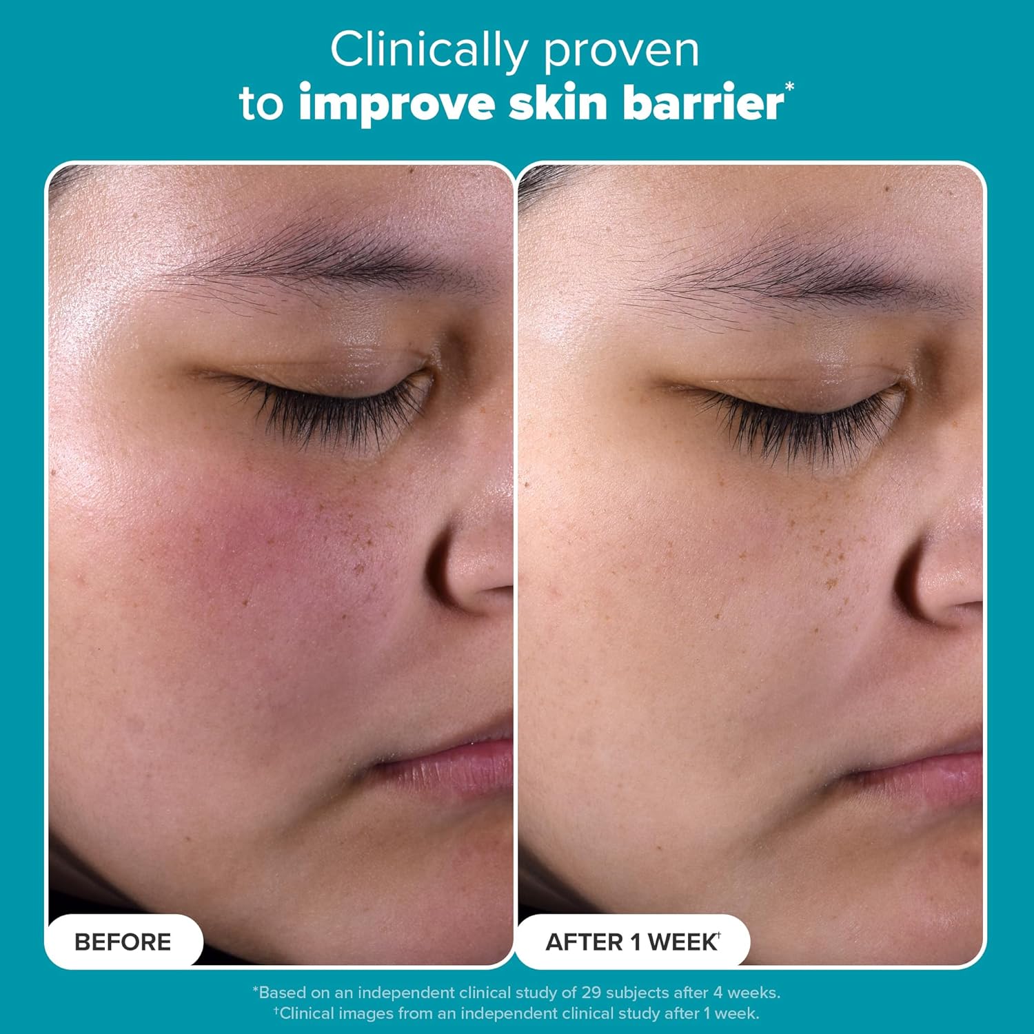 Skin Perfecting 2% BHA Liquid Exfoliant with Salicylic Acid for Pores & Skin Texture