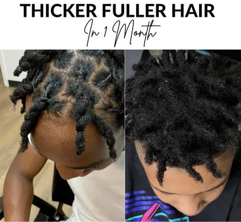 Scalp Stimulator Hair Growth Oil for Hair Thinning & Thicker Hair