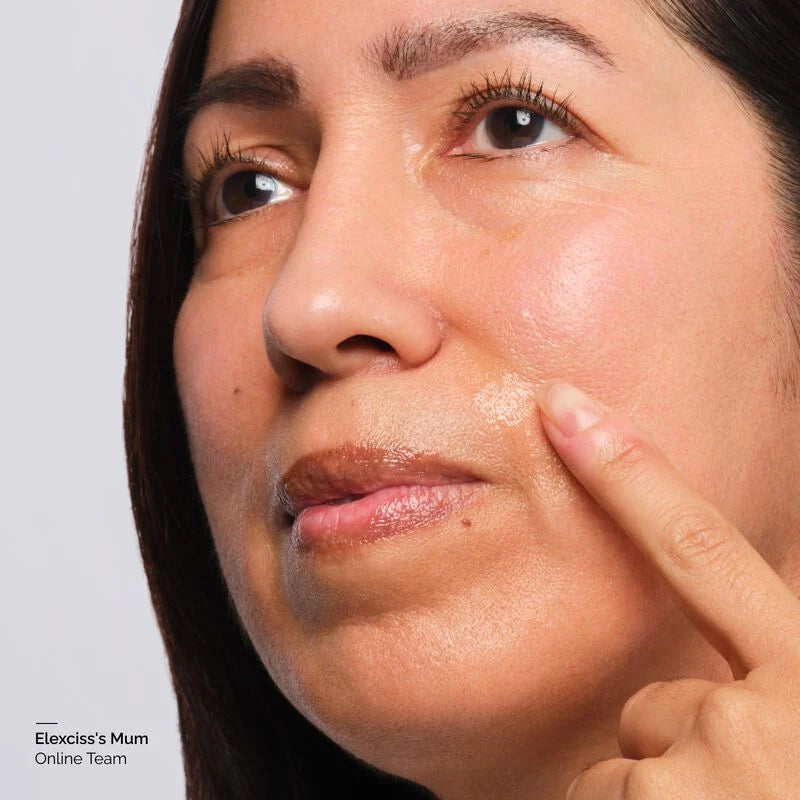 Volufiline 92% Plus Pal-Isoleucine 1% for Plumping & Skin Elasticity