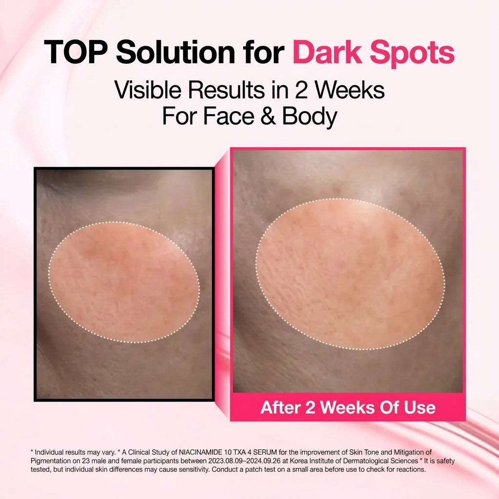 Niacinamide 10% + TXA 4% & 2% Arbutin Dark Spot Correcting Serum