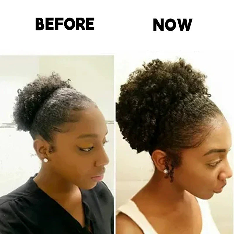Scalp Stimulator Hair Growth Oil for Hair Thinning and Thicker Hair