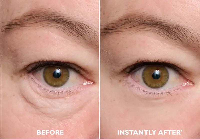 Instant FIRMx Eye Temporary Eye Tightener for Puffiness, Fine Lines & Crow's Feet
