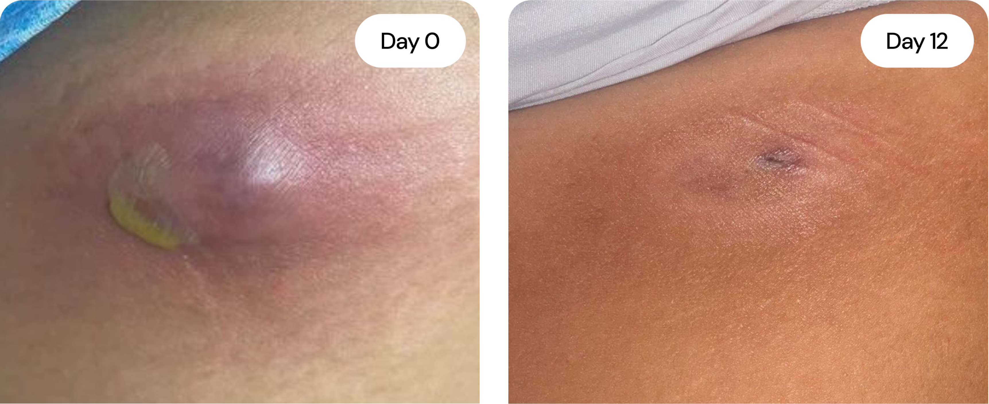 Universal Flare Care Sensitive Skin Cream with Propolis for Dry Skin & Hydration