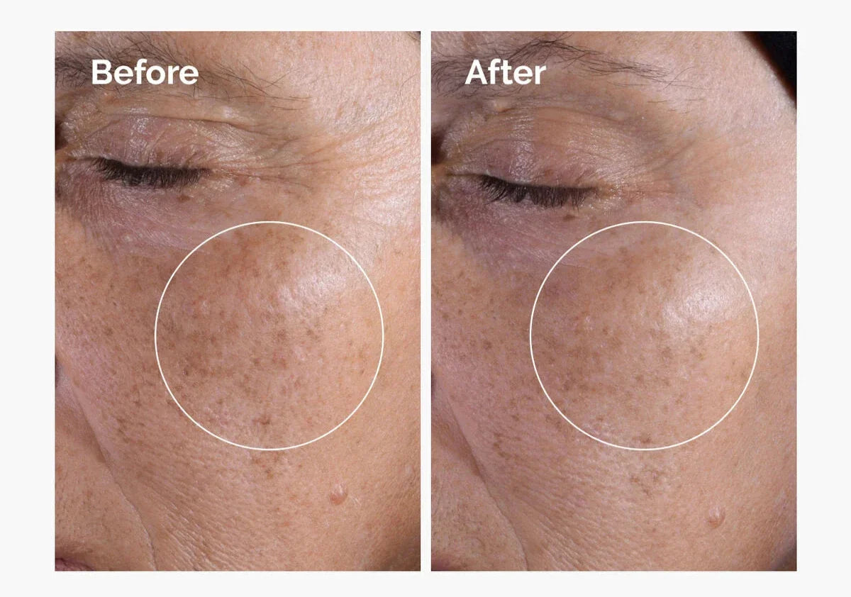 Glycolic Acid 7% Toning Solution for Dull Skin, Skin Tone & Texture