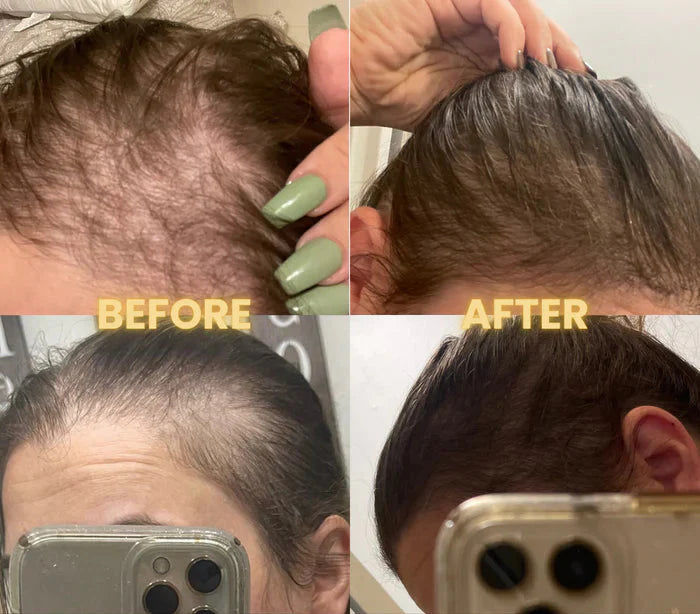 Scalp Stimulator Hair Growth Oil for Hair Thinning & Thicker Hair